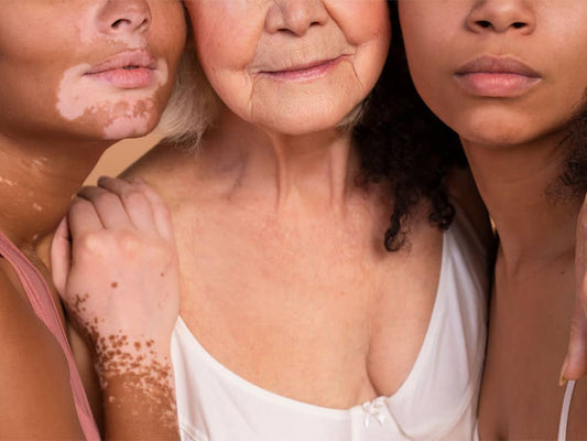 Device for Your Skin Type